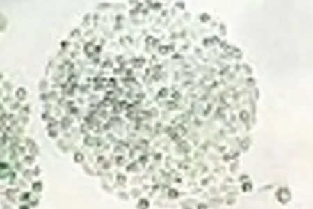 HeLa cells